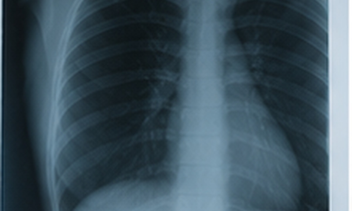X-Ray transparency film